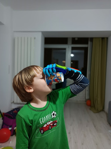 Tudor, a five-year-old Romanian, uses a hand fabricated by Sage Prosthetics.